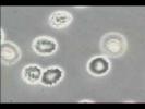 Red Blood Cells in a Hypertonic Solution