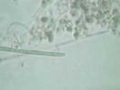 Bacterial Motility